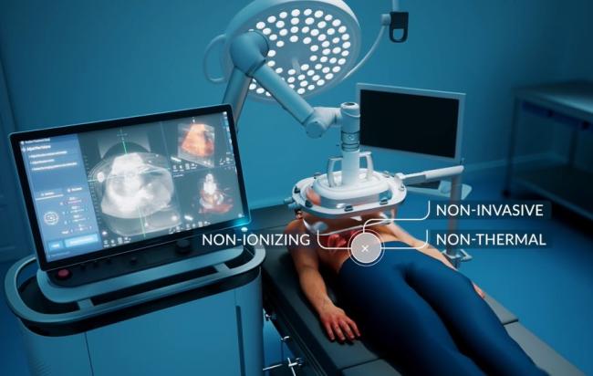 image shows pateint on table with histotripsy treatment head posititioned over their body