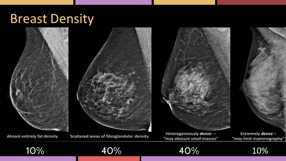 Four mammogram types depicting varying levels of breast tissue density.