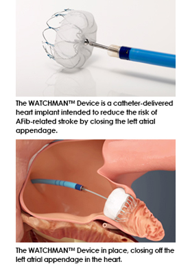 Illustrations of WATCHMAN™ device: insertion tool and heart placement.