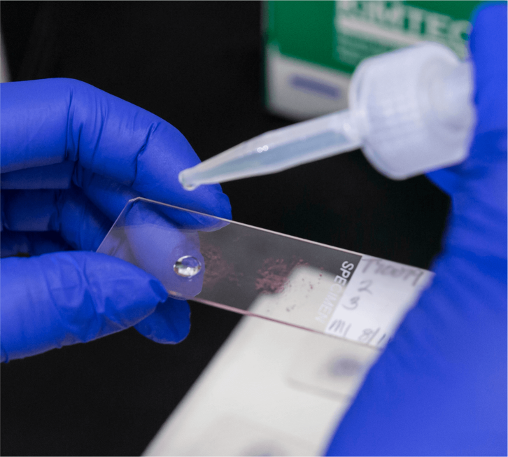 Gloved hands in a lab using a pipette to place liquid onto a microscope slide