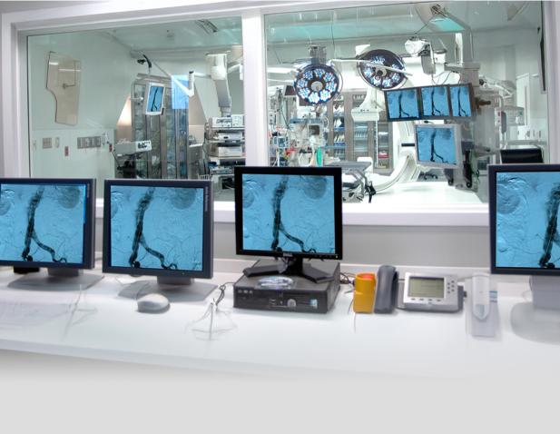 Control room view into a high-tech surgical suite with multiple monitors displaying vascular imaging.