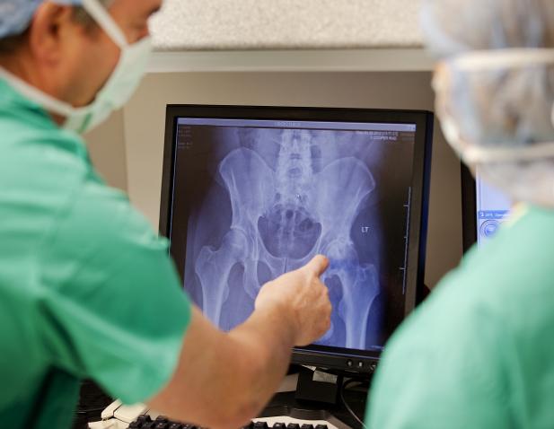 doctors viewing x-ray of hip