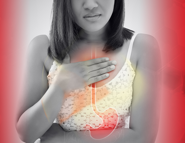 Advanced Treatment Options for GERD