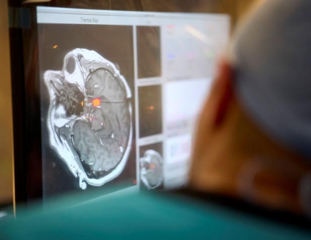 Dr. Fayed looking at an image of the brain during LITT procedure