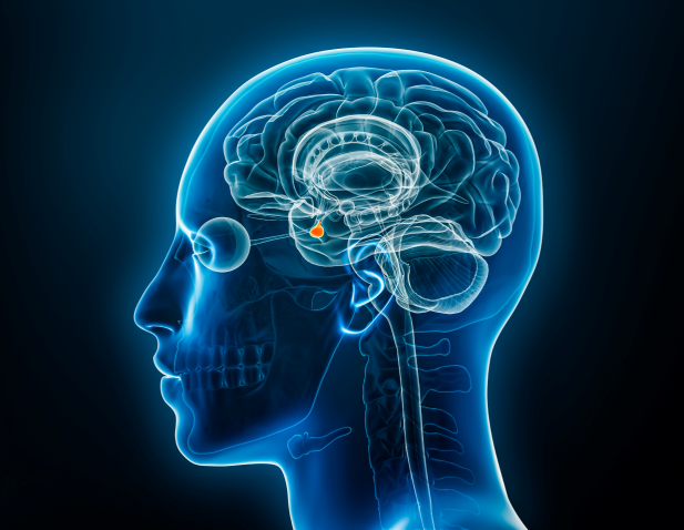 Medical illustration of a pituitary tumor.