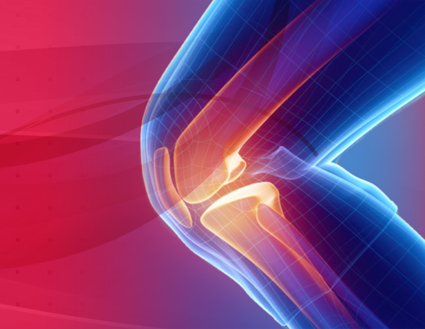 image for knee replacement