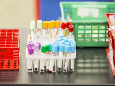 Multi-color laboratory blood test tubes