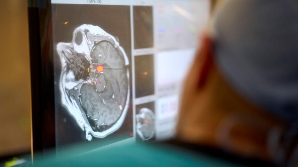 Fayed Functional Neurosurgery